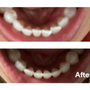 Photo of Center For Beautiful Smiles