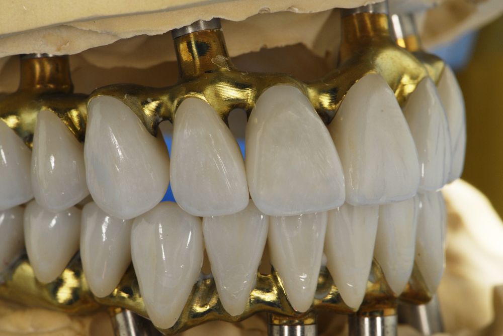 WIAND DENTAL LAB Updated September 2024 33 Photos 10555 N 114th