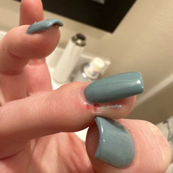LV Nail Spa - Large cut along finger - Nail Salons Near Me - Fort Collins, Colorado LV Nail Spa - Large cut along finger - Nail Salons Near Me - Fort Collins, Colorado