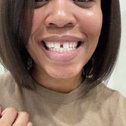 Illuminated Smiles - First treatment