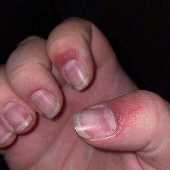 Master Nails - Getting worse. - Nail Salons Near Me - Mukilteo, Washington