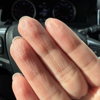 Kensington Nails And Spa - Residue left on hand. - Nail Salons Near Me - San Diego, California Kensington Nails And Spa - Residue left on hand. - Nail Salons Near Me - San Diego, California