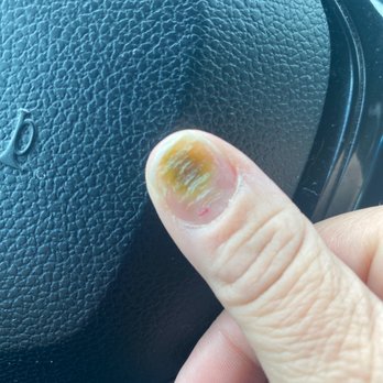 8 Pretty Nails and Spa - Fungal infection in my nail - Nail Salons Near Me - Surprise, Arizona