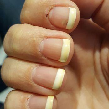 Empire Nails - My French tips that turned orange a day later. Note my scabs on my cuticles. - Nail Salons Near Me - Sedona, Arizona Empire Nails - My French tips that turned orange a day later. Note my scabs on my cuticles. - Nail Salons Near Me - Sedona, Arizona