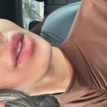 Saint Aesthetix - Lip filler - Medical Spas Near Me - Monrovia, California Saint Aesthetix - Lip filler - Medical Spas Near Me - Monrovia, California