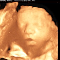 Hello Baby 3D/4D Ultrasound