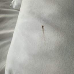 bed bug bite blood on our pillow