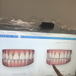 They have the latest technology to show you how your teeth can change with Invisalign treatment. Isn't that cool?!