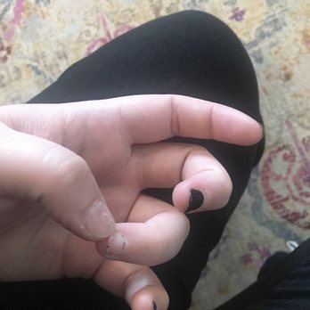Herbal Nails - 4 of my friend's nails came off after 3-4 days - Nail Salons Near Me - Portsmouth, New Hampshire Herbal Nails - 4 of my friend's nails came off after 3-4 days - Nail Salons Near Me - Portsmouth, New Hampshire