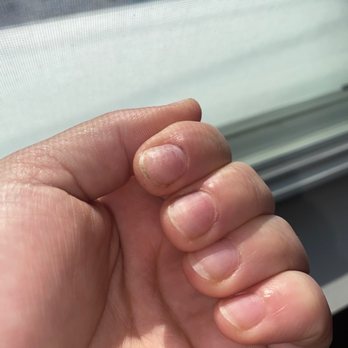QT Nails - Gunk left under my nails and raw cuticles from being nicked by the drill so many times - Nail Salons Near Me - Traverse City, Michigan QT Nails - Gunk left under my nails and raw cuticles from being nicked by the drill so many times - Nail Salons Near Me - Traverse City, Michigan