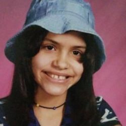 Yanni Family Orthodontics - Before braces