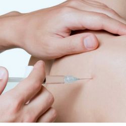 Herbs4Cures - Bio puncture for sports injury , pain management