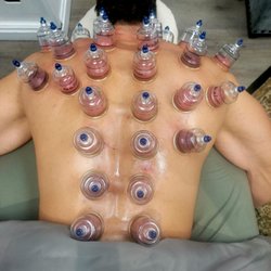 DaVinci Body & Beauty - Cupping therapy