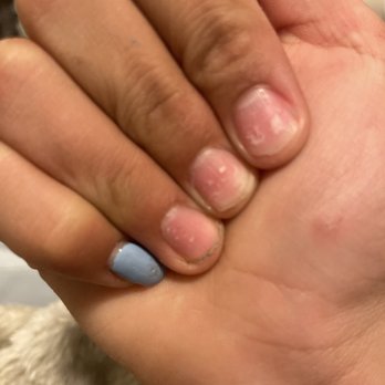 Lily Nails - They still hurt I just recommend not going there.. - Nail Salons Near Me - Denver, Colorado Lily Nails - They still hurt I just recommend not going there.. - Nail Salons Near Me - Denver, Colorado