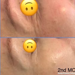 Noor  Spa - Microcurrent Facial This facial will leave your skin looking firmer lifted and younger, no matter what age you are!