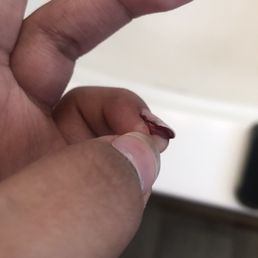 Bloody cut on nail Bloody cut on nail