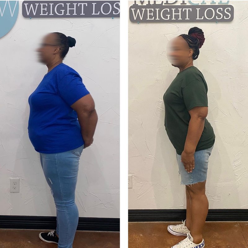 RENEW MEDICAL WEIGHT LOSS 18 Photos & 12 Reviews 1651 Justin Rd, Flower Mound, Texas