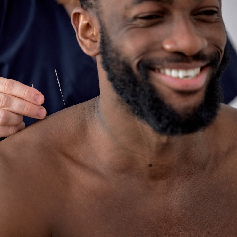 FREE Acupuncture Session on Your 7th Visit!