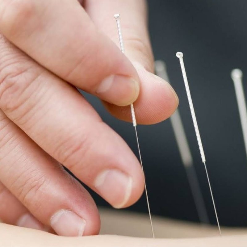 BL ACUPUNCTURE CLINIC 15 Photos 650 Mowry Ave, Fremont, California