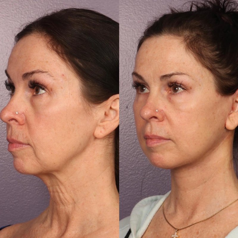 DANIEL J GOULD, MD PHD Updated October 2024 343 Photos & 46 Reviews