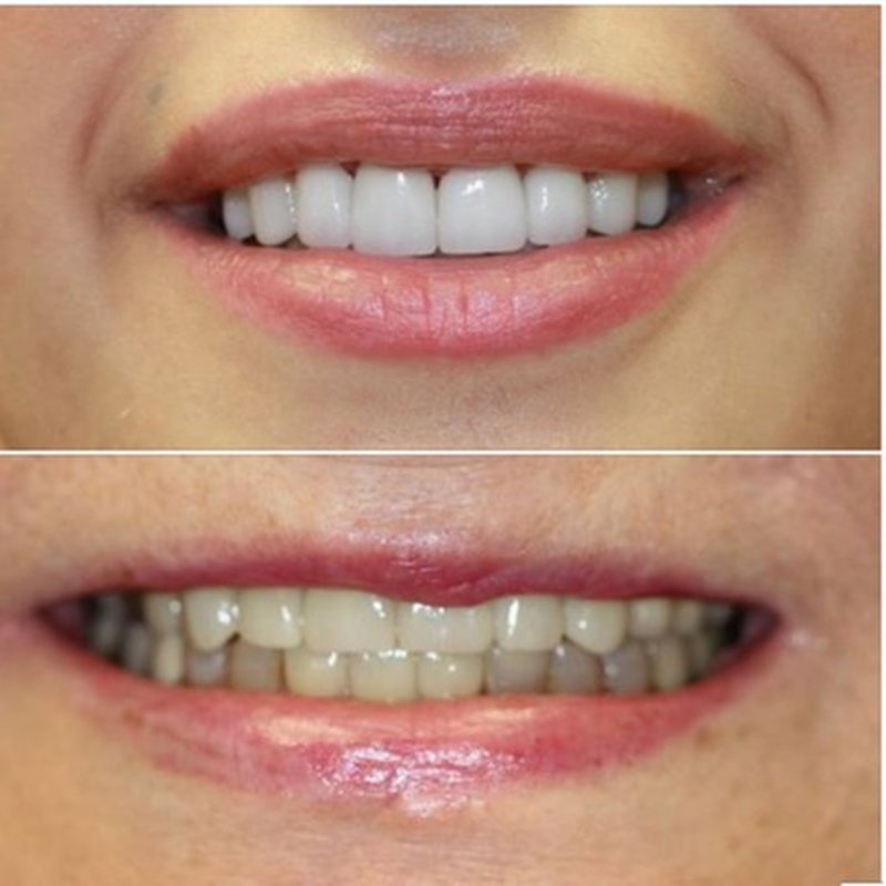 TITAN DENTAL CARE Updated September 2024 72 Photos & 76 Reviews