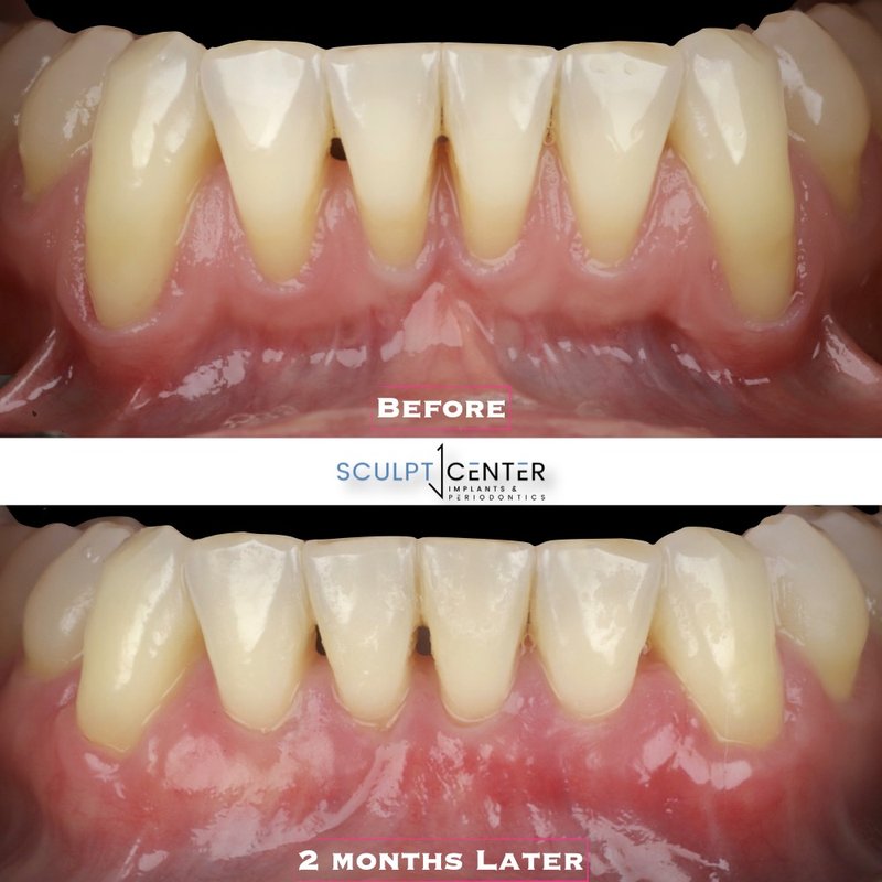 SCULPT CENTER FOR IMPLANTS & PERIODONTICS 20 Photos 8201 Greensboro