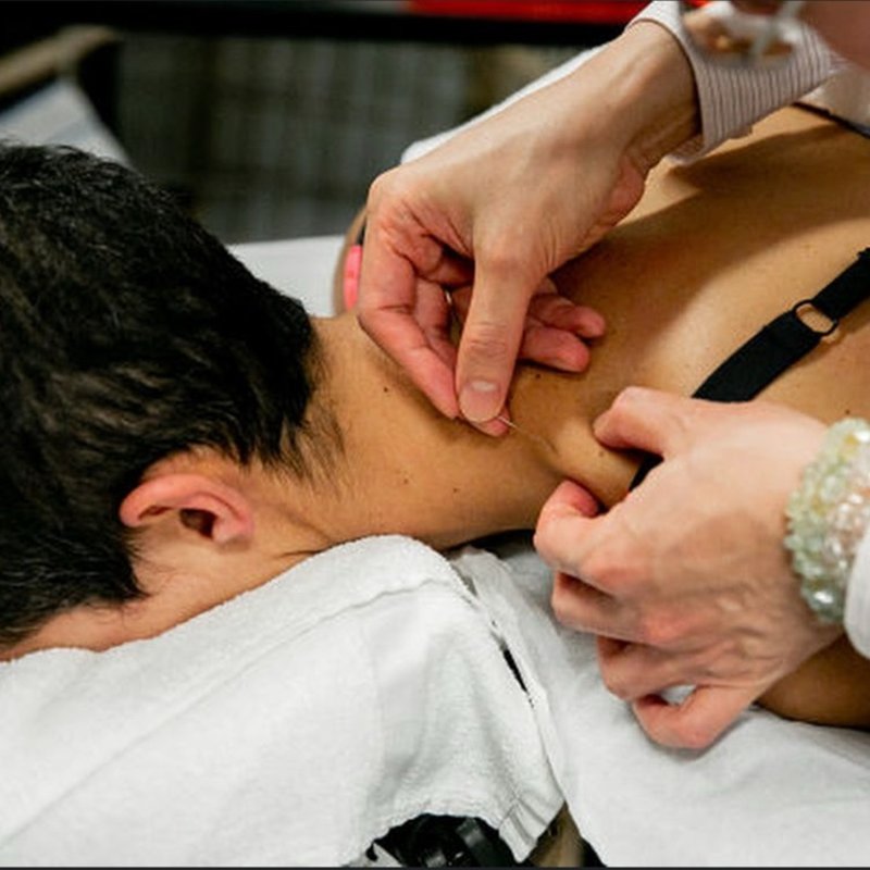 Acupuncture for Better Sleep