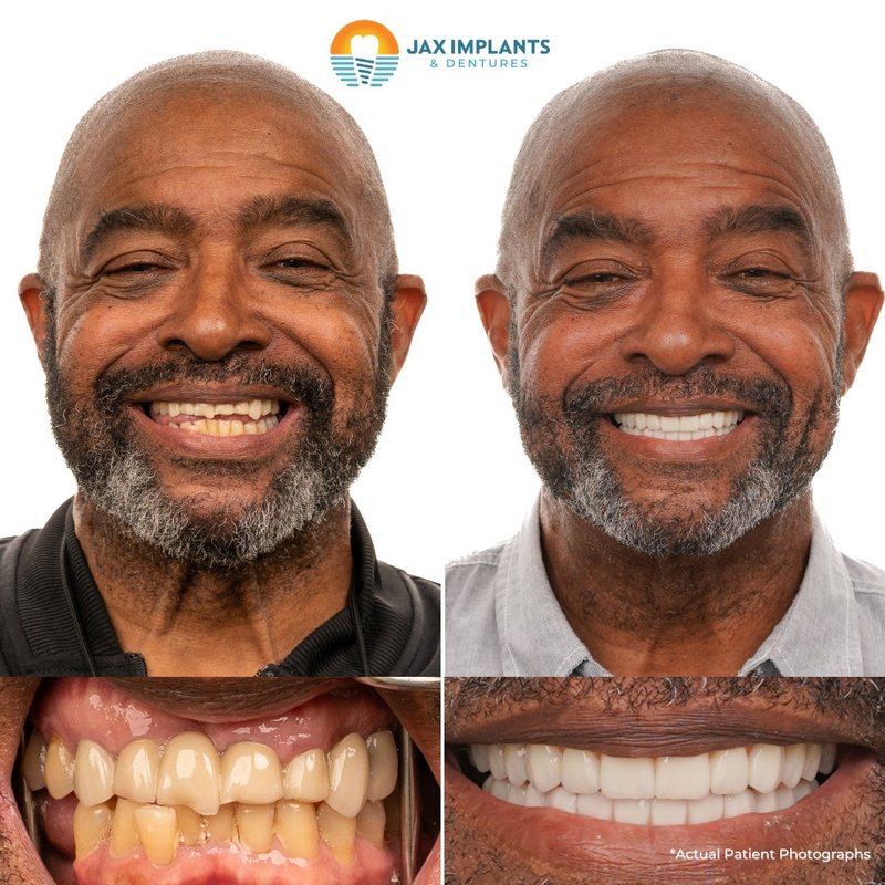 Jax Implants And Dentures Reviews