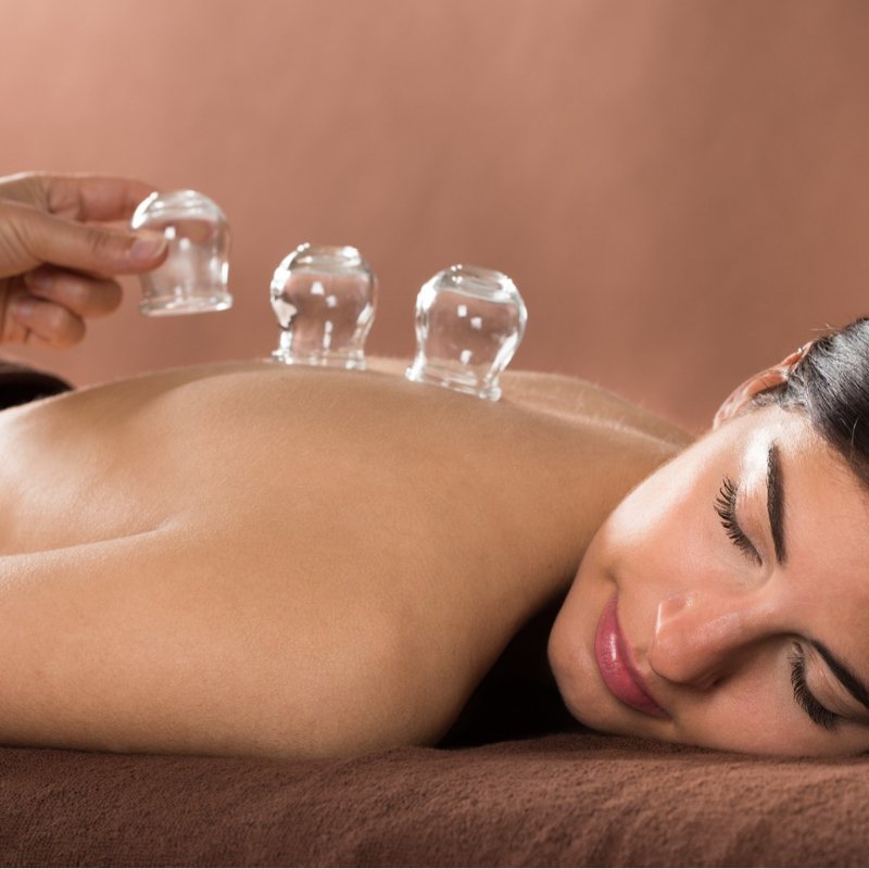 Relieve your muscle pain with cupping therapy