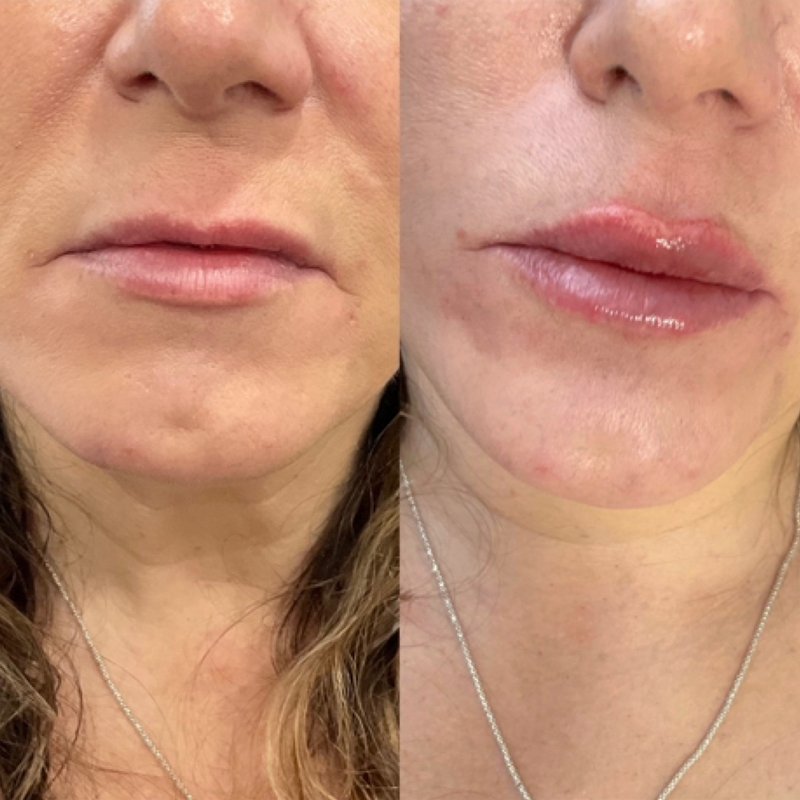 BUTTERFLY AESTHETICS 19 Photos 251 Richmond Hill Rd, Staten Island