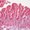 Photo of Intestinal E.