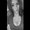 Photo of Pyper M.
