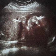 GILL OB/GYN MEDICAL GROUP - Updated January 2026 - 100 Reviews - 1617 N ...