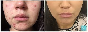 Skin Care - We can help with most skin problems and can customize your treatment specifically for your skin. Skin Care - We can help with most skin problems and can customize your treatment specifically for your skin.