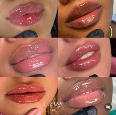 Before and After - Lips created just for YOU. Not two lips are the same because we are all different and unique, so let's keep it that way.
Appointments available, accepting new clients. Before and After - Lips created just for YOU. Not two lips are the same because we are all different and unique, so let's keep it that way.
Appointments available, accepting new clients.