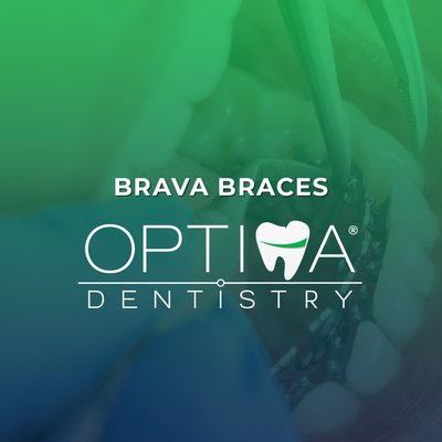 Brava Braces - Looking for professional Brava by BRIUS invisible braces? CALL NOW and book your appointment today Brava Braces - Looking for professional Brava by BRIUS invisible braces? CALL NOW and book your appointment today