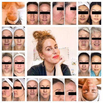We specialize in skin transformation. You with your healthiest most vibrant skin. - What happens when you find the right skin care routine and nourish your skin with the right facials?
Supple, healthy glowing skin ☺️!
Are YOU ready to transform your skin?
Spring is the PERFECT time to switch up your skin care regimen and to FINALLY get that service to take your skin to its next level!
We can help you switch up your home care and select the facials that will bring you the results you want.
Curious? Questions? Send us a message! We specialize in skin transformation. You with your healthiest most vibrant skin. - What happens when you find the right skin care routine and nourish your skin with the right facials?
Supple, healthy glowing skin ☺️!
Are YOU ready to transform your skin?
Spring is the PERFECT time to switch up your skin care regimen and to FINALLY get that service to take your skin to its next level!
We can help you switch up your home care and select the facials that will bring you the results you want.
Curious? Questions? Send us a message!