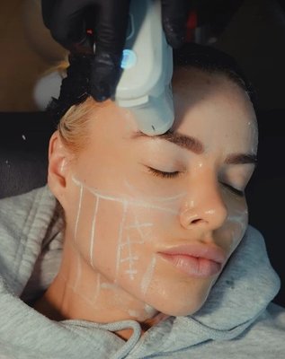Ultherapy® Non Surgical Ultrasound Therapy - Ultherapy is the only FDA-cleared, non-invasive procedure that lifts the neck, chin and brow, and improves lines and wrinkles on the upper chest. Through the ultrasound imaging with Ultherapy, energy is delivered precisely to the place where it will benefit you most—for natural-looking results that improve over time Ultherapy® Non Surgical Ultrasound Therapy - Ultherapy is the only FDA-cleared, non-invasive procedure that lifts the neck, chin and brow, and improves lines and wrinkles on the upper chest. Through the ultrasound imaging with Ultherapy, energy is delivered precisely to the place where it will benefit you most—for natural-looking results that improve over time