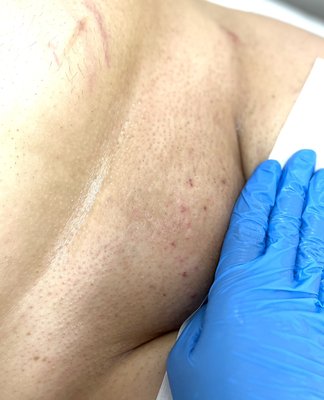 Brazilian Wax - Brazilian Client