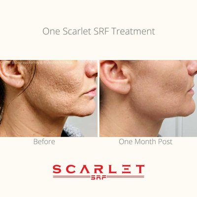 Med-Aesthetics - At our med spa, we specialize in advanced medical aesthetic treatments designed to rejuvenate, restore, and enhance your natural beauty. With a focus on non-surgical, results-driven procedures, we offer a wide range of services including sclerotherapy, SkinVive by Juvéderm, microneedling, PRP and PRF therapies (including Cellenis Derma PRP), and PRP hair restoration with AquaFirme DS. Our skilled team also provides cutting-edge solutions for skin concerns such as xanthelasma and milia removal, cherry angioma treatment, and IPL photorejuvenation. We’re proud to offer Plasmage treatments for precision skin tightening and contouring, along with expert Botox injections for wrinkle reduction and facial refinement. At the heart of everything we do is a commitment to safe, customized care that helps you look and feel your best—refreshed, confident, and radiant. Med-Aesthetics - At our med spa, we specialize in advanced medical aesthetic treatments designed to rejuvenate, restore, and enhance your natural beauty. With a focus on non-surgical, results-driven procedures, we offer a wide range of services including sclerotherapy, SkinVive by Juvéderm, microneedling, PRP and PRF therapies (including Cellenis Derma PRP), and PRP hair restoration with AquaFirme DS. Our skilled team also provides cutting-edge solutions for skin concerns such as xanthelasma and milia removal, cherry angioma treatment, and IPL photorejuvenation. We’re proud to offer Plasmage treatments for precision skin tightening and contouring, along with expert Botox injections for wrinkle reduction and facial refinement. At the heart of everything we do is a commitment to safe, customized care that helps you look and feel your best—refreshed, confident, and radiant.