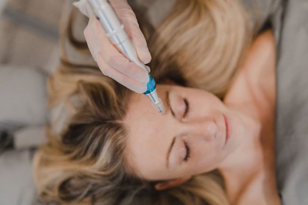 Microneedling - We are now offering microneedling! Microneedling treats wrinkles, minor-scars, age spots, acne, skin tone and texture and hair growth. After a course of 8-10 treatments results can last 3-5 years. Initial results can be seen after 3 treatments. All treatments include 30 minutes of Celluma LED light therapy, a mini acupuncture treatment and customized herbal serums to bring home