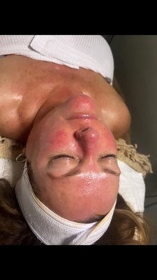 Facial services - These photos are the results of the different facials I offer. All clients left happy and skin glowing ! Facial services - These photos are the results of the different facials I offer. All clients left happy and skin glowing !