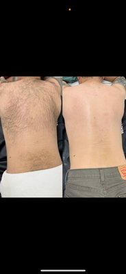 Waxing - Waxing for women and men Waxing - Waxing for women and men