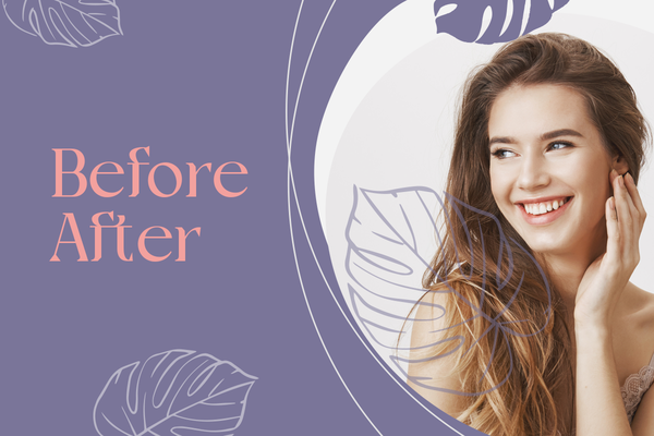 Before | After - The results of skin transformation. The work of the Metodica cosmetology team Before | After - The results of skin transformation. The work of the Metodica cosmetology team