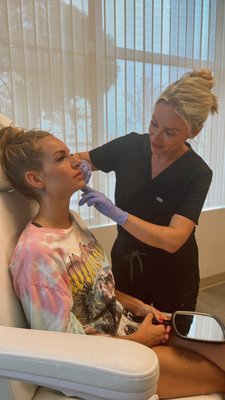 Lip Filler - JUVÉDERM® is a non-animal based injectable filler made in the laboratory. It is made of hyaluronic acid - a material that is in the joints and bodies of all living things. A simple, non surgical, nurse-administered treatment, JUVÉDERM® injectable gel can temporarily add volume and diminish wrinkles and folds in many areas. Lip Filler - JUVÉDERM® is a non-animal based injectable filler made in the laboratory. It is made of hyaluronic acid - a material that is in the joints and bodies of all living things. A simple, non surgical, nurse-administered treatment, JUVÉDERM® injectable gel can temporarily add volume and diminish wrinkles and folds in many areas.