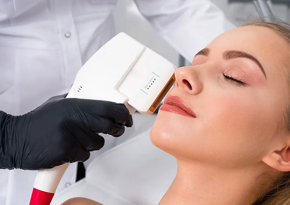 Non-surgical Face Lifting - Elevate your skincare routine with our HIFU face lifting treatment
Designed to lift and tighten sagging skin without surgery, HIFU (High-Intensity Focused Ultrasound) uses targeted energy to stimulate collagen production deep within the skin. This non-invasive procedure improves skin elasticity, reduces wrinkles, and defines facial contours for a youthful appearance. Perfect for those seeking visible results without downtime. Contact us today to rejuvenate your natural beauty. Non-surgical Face Lifting - Elevate your skincare routine with our HIFU face lifting treatment
Designed to lift and tighten sagging skin without surgery, HIFU (High-Intensity Focused Ultrasound) uses targeted energy to stimulate collagen production deep within the skin. This non-invasive procedure improves skin elasticity, reduces wrinkles, and defines facial contours for a youthful appearance. Perfect for those seeking visible results without downtime. Contact us today to rejuvenate your natural beauty.