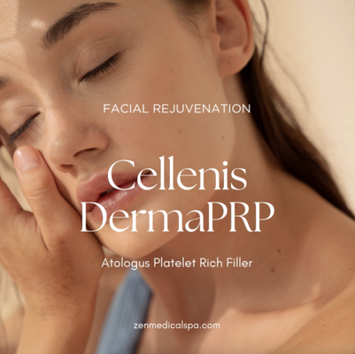 Cellenis Derma Filler - PRP Derma Filler is a new biologic or natural approach to dermal fillers. We create the thick PRP from your own plasma by heating and cooling it and turn it into a dermal filler with your own body stem cells and fat. We can create between 4 and 10 syringes from your own cells. Call us for more information or book online for a free consultation. See if it is on special this month! Cellenis Derma Filler - PRP Derma Filler is a new biologic or natural approach to dermal fillers. We create the thick PRP from your own plasma by heating and cooling it and turn it into a dermal filler with your own body stem cells and fat. We can create between 4 and 10 syringes from your own cells. Call us for more information or book online for a free consultation. See if it is on special this month!