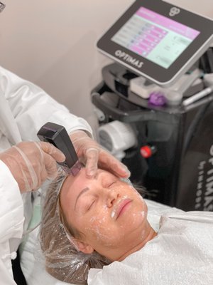 Morpheus8 RF Microneedling - Morpheus8 RF Microneedling is a fractional skin treatment that stimulates collagen production of the underlying layers of the dermis.
By targeting the deeper layers of the skin, the building blocks will reorganize themselves in a natural anti-aging process.
Morpheus8 is a device that combines microneedling with radiofrequency technology for fractional resurfacing that stimulates collagen production.
It can be used on any areas that can benefit from sub-dermal renewal. Areas of the face and body that exhibit wrinkles, discoloration, or acne scarring are suitable for treatment. The most commonly treated areas include the face and neck, as well as the abdomen which is beneficial for tightening loose skin with underlying fatty tissue. Morpheus8 RF Microneedling - Morpheus8 RF Microneedling is a fractional skin treatment that stimulates collagen production of the underlying layers of the dermis.
By targeting the deeper layers of the skin, the building blocks will reorganize themselves in a natural anti-aging process.
Morpheus8 is a device that combines microneedling with radiofrequency technology for fractional resurfacing that stimulates collagen production.
It can be used on any areas that can benefit from sub-dermal renewal. Areas of the face and body that exhibit wrinkles, discoloration, or acne scarring are suitable for treatment. The most commonly treated areas include the face and neck, as well as the abdomen which is beneficial for tightening loose skin with underlying fatty tissue.