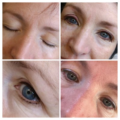 Eyeliner Enhancement Tattoo - A runners dream! This wonderful lady wanted to wake up and not have to put on her "eyes"! Eyeliner enhancement is a great way to get those eyes to pop and won't wipe off with a sweaty workout. Call today for your consultation. Eyeliner Enhancement Tattoo - A runners dream! This wonderful lady wanted to wake up and not have to put on her "eyes"! Eyeliner enhancement is a great way to get those eyes to pop and won't wipe off with a sweaty workout. Call today for your consultation.