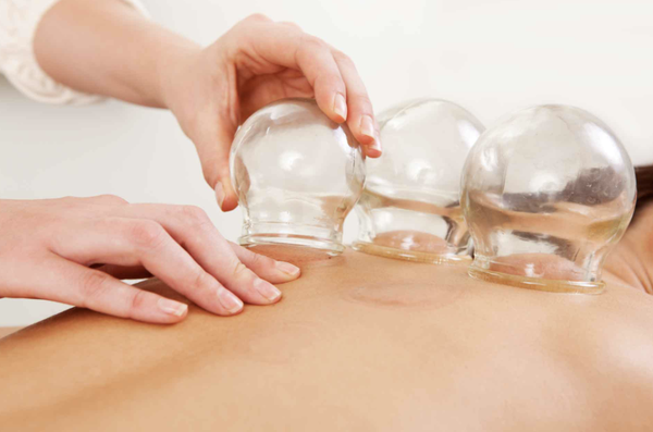 Medi-Cupping Massage - At Integrity Therapeutic Massage and Wellness, we offer Medi-Cupping Massage, a specialized therapy that combines traditional massage techniques with suction cups to release tension, improve circulation, and promote deep healing. This gentle yet effective treatment helps reduce muscle tightness, detoxify tissues, and enhance overall well-being.
Our Medi-Cupping sessions include:
30-Minute Medi-Cupping Massage – $80: A targeted treatment for specific areas of tension, ideal for pain relief and muscle recovery.
60-Minute Medi-Cupping Massage – $120: A full-body session that deeply relaxes muscles, improves lymphatic flow, and supports overall rejuvenation.
Whether you're looking to relieve chronic pain, recover from an injury, or simply experience the therapeutic benefits of cupping, our expert practitioners are here to help. Book your session today and discover the power of Medi-Cupping! Medi-Cupping Massage - At Integrity Therapeutic Massage and Wellness, we offer Medi-Cupping Massage, a specialized therapy that combines traditional massage techniques with suction cups to release tension, improve circulation, and promote deep healing. This gentle yet effective treatment helps reduce muscle tightness, detoxify tissues, and enhance overall well-being.
Our Medi-Cupping sessions include:
30-Minute Medi-Cupping Massage – $80: A targeted treatment for specific areas of tension, ideal for pain relief and muscle recovery.
60-Minute Medi-Cupping Massage – $120: A full-body session that deeply relaxes muscles, improves lymphatic flow, and supports overall rejuvenation.
Whether you're looking to relieve chronic pain, recover from an injury, or simply experience the therapeutic benefits of cupping, our expert practitioners are here to help. Book your session today and discover the power of Medi-Cupping!
